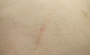 Foto: Ustupljena fotografija / Povrede dječaka