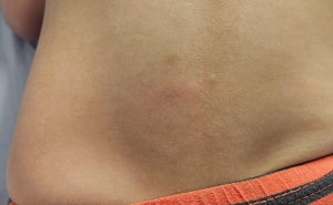 Foto: Ustupljena fotografija / Povrede dječaka