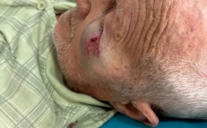 Foto: Radio Gračanica / Povrijeđeni 84-godišnjak