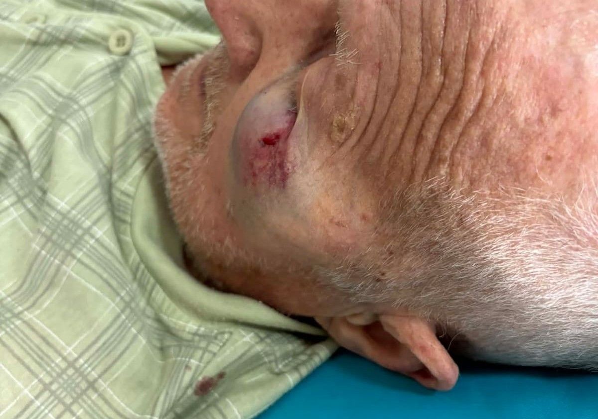 Povrijeđeni 84-godišnjak