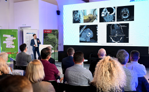 Foto: N. G. / Radiosarajevo.ba / Stručni simpozij u ASA bolnici fokusiran na moderne terapije kardiovaskularnih bolesti