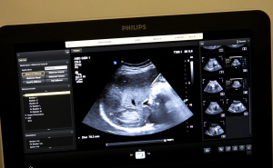 Foto: Institut za zdravlje i sigurnost hrane Zenica  / Doktori