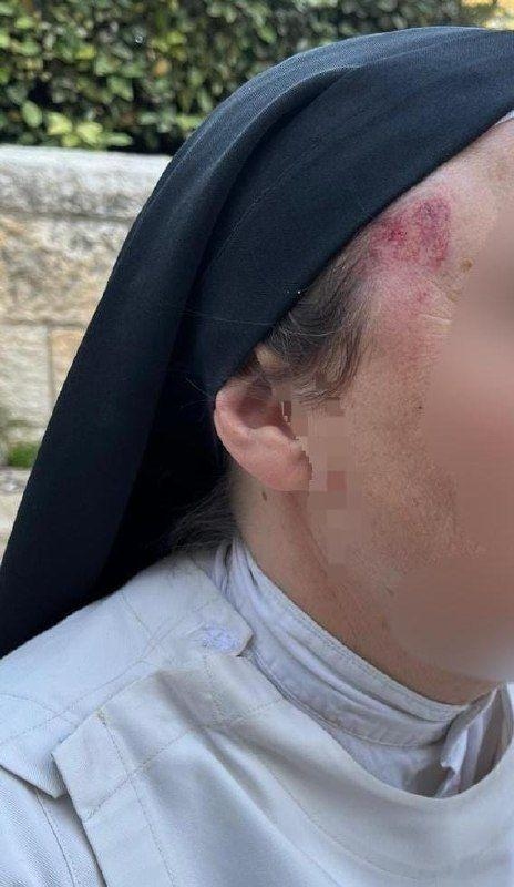 Časna sestra je zadobila povrede glave